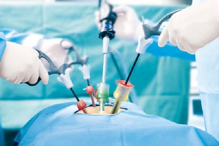 جراحی لاپاراسکوپی جراحی لاپاراسکوپی چقدر ایمن و بی خطر است؟